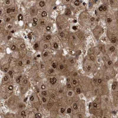 RAD23B Antibody in Immunohistochemistry (IHC)