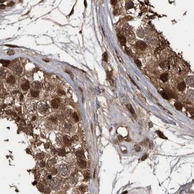 RAD23B Antibody in Immunohistochemistry (IHC)