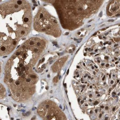 RAD23B Antibody in Immunohistochemistry (IHC)