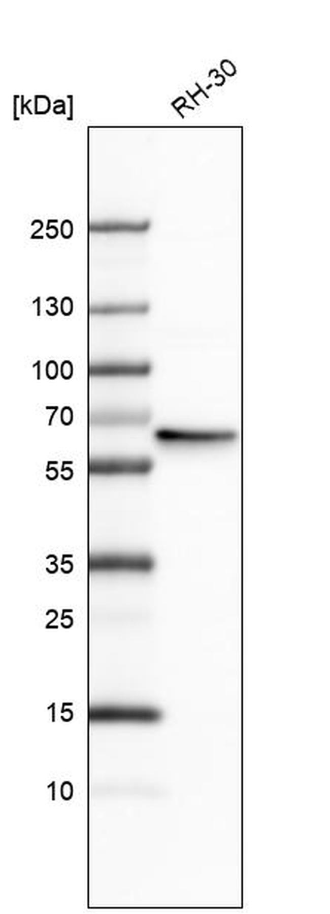 RAD23B Antibody in Western Blot (WB)