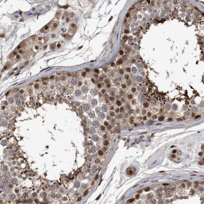 RAD23B Antibody in Immunohistochemistry (IHC)