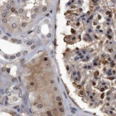 RAD23B Antibody in Immunohistochemistry (IHC)