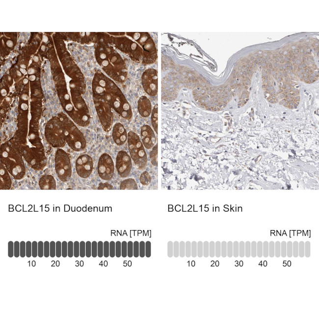 BCL2L15 Antibody in Immunohistochemistry (IHC)