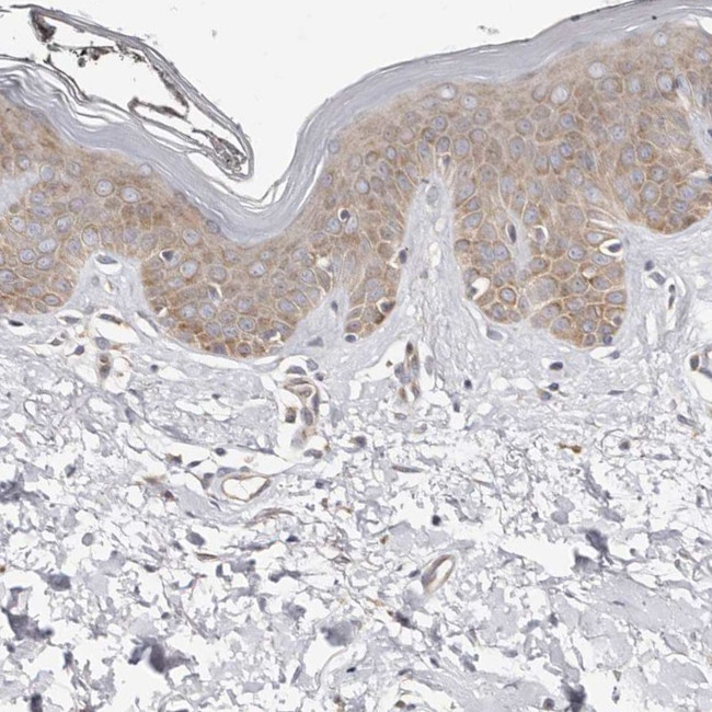 BCL2L15 Antibody in Immunohistochemistry (IHC)