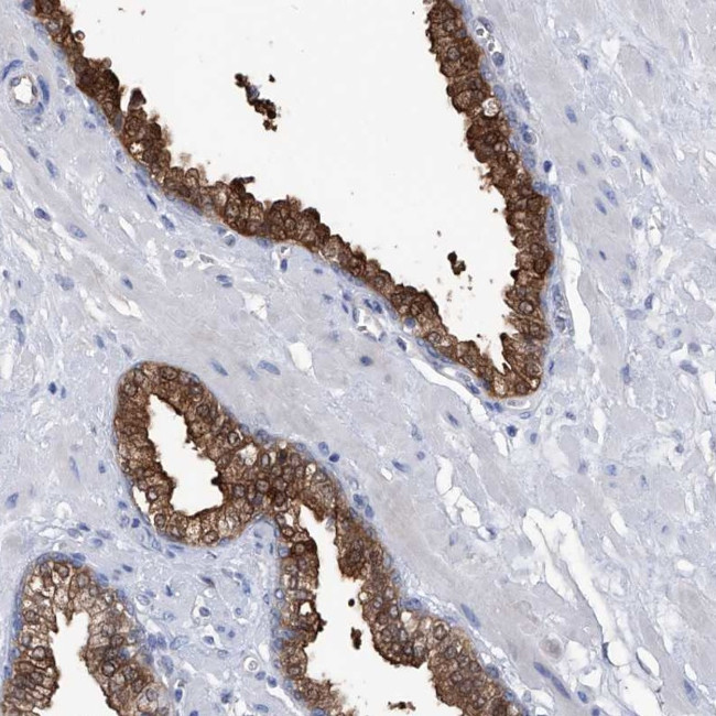 PGM3 Antibody in Immunohistochemistry (IHC)