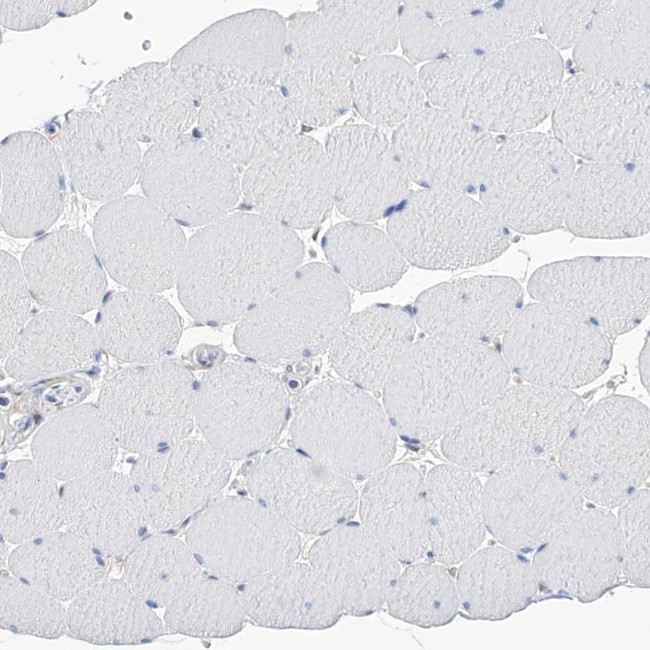 PGM3 Antibody in Immunohistochemistry (IHC)