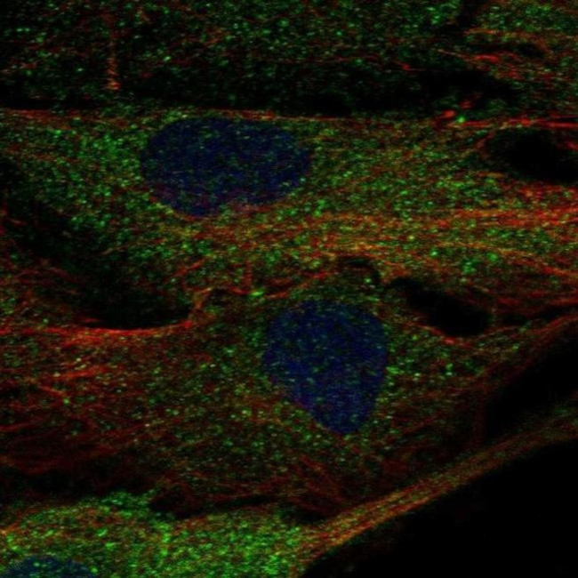 ALPK2 Antibody in Immunocytochemistry (ICC/IF)