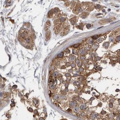 DARS Antibody in Immunohistochemistry (IHC)