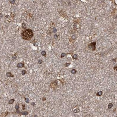 DARS Antibody in Immunohistochemistry (IHC)