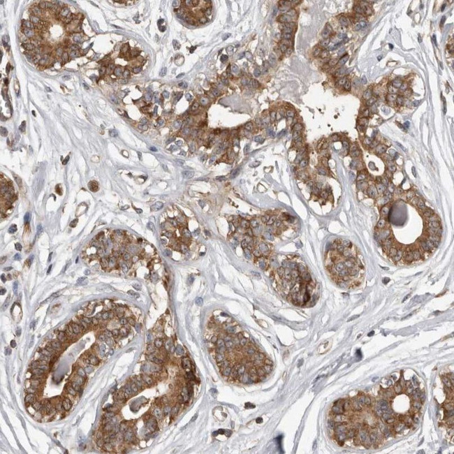 DARS Antibody in Immunohistochemistry (IHC)