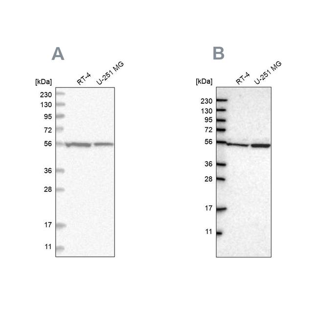 DARS Antibody in Western Blot (WB)