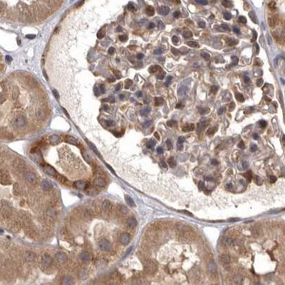 DARS Antibody in Immunohistochemistry (IHC)