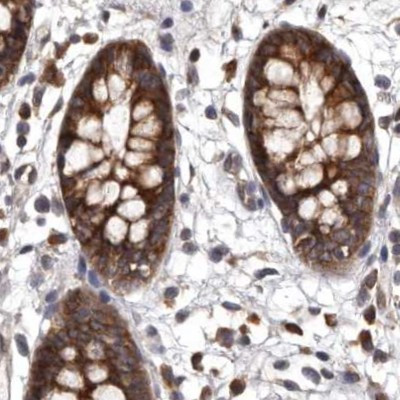 DARS Antibody in Immunohistochemistry (IHC)