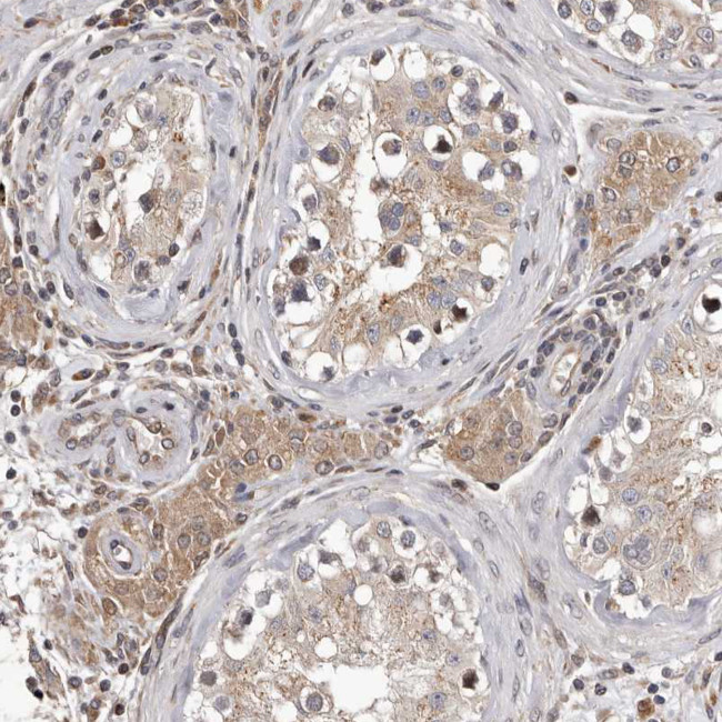 GADD45B Antibody in Immunohistochemistry (IHC)