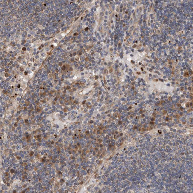 GADD45B Antibody in Immunohistochemistry (IHC)