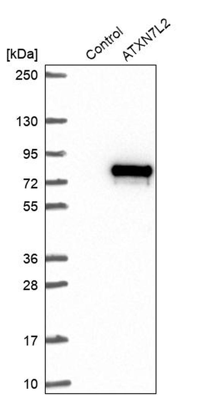 ATXN7L2 Antibody in Western Blot (WB)