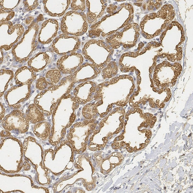 LALBA Antibody in Immunohistochemistry (IHC)