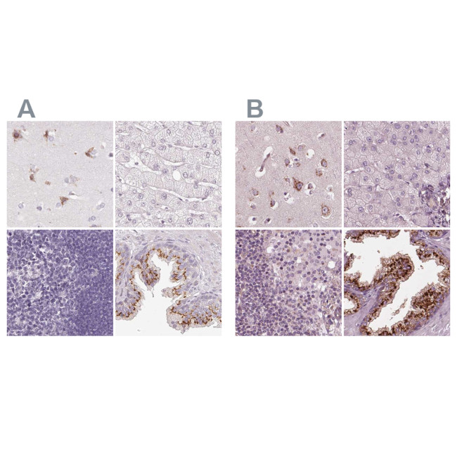 KIAA1324 Antibody in Immunohistochemistry (IHC)