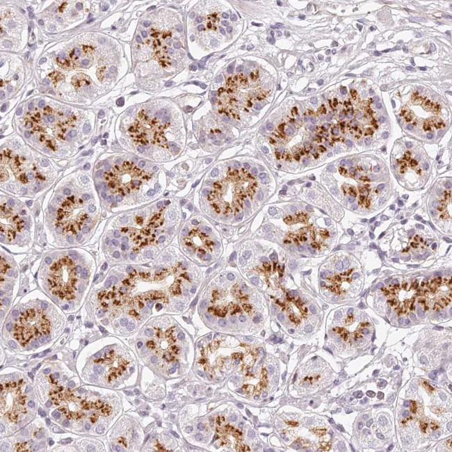 KIAA1324 Antibody in Immunohistochemistry (IHC)