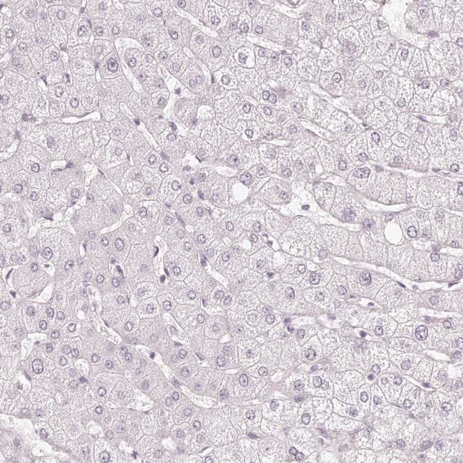 KIAA1324 Antibody in Immunohistochemistry (IHC)