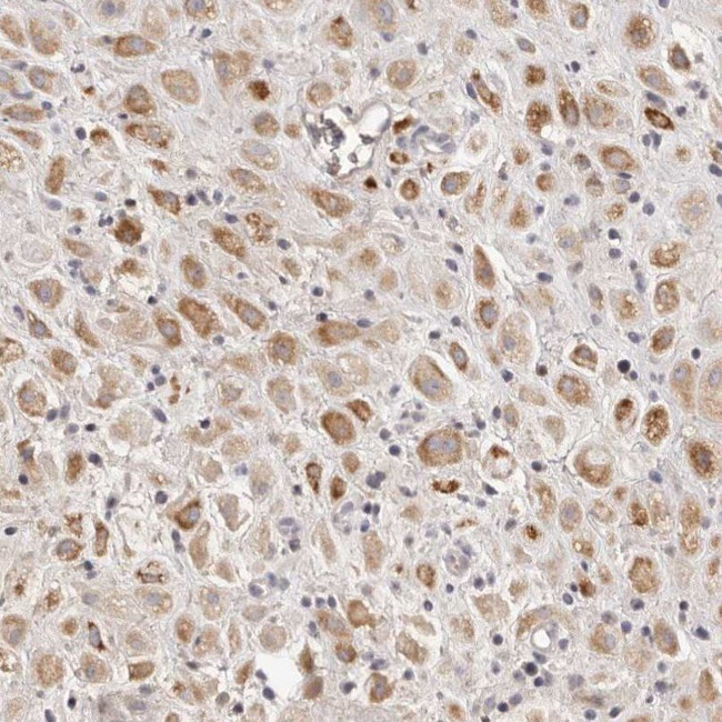 SCUBE2 Antibody in Immunohistochemistry (IHC)