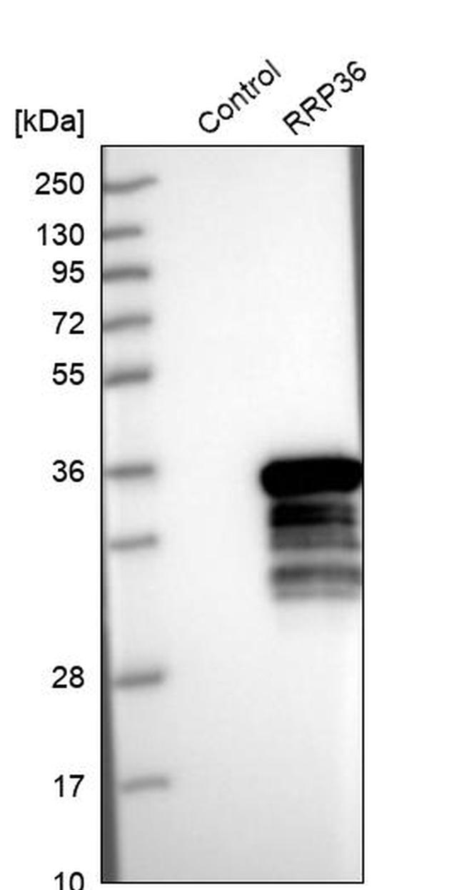 RRP36 Antibody in Western Blot (WB)