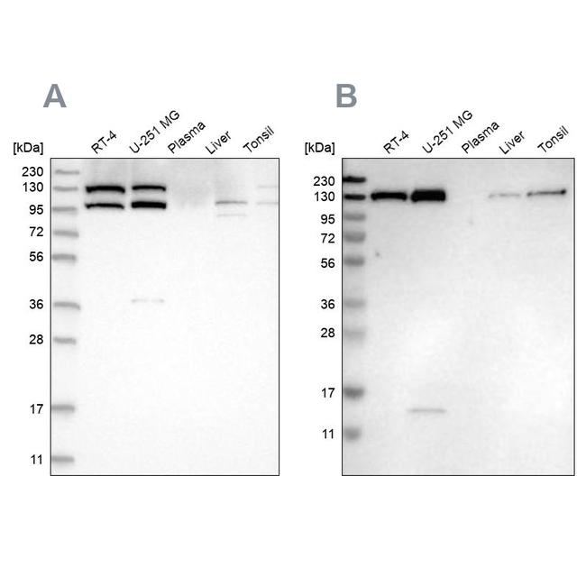 XPO5 Antibody in Western Blot (WB)