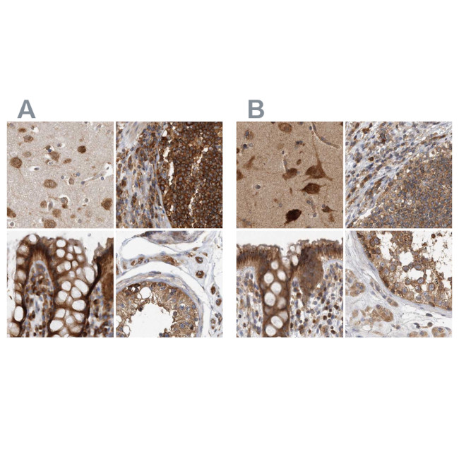 eIF3i Antibody in Immunohistochemistry (IHC)