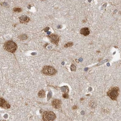 eIF3i Antibody in Immunohistochemistry (IHC)