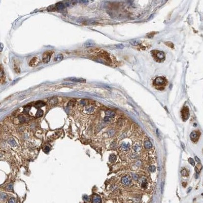 eIF3i Antibody in Immunohistochemistry (IHC)