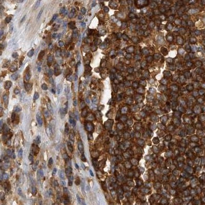 eIF3i Antibody in Immunohistochemistry (IHC)