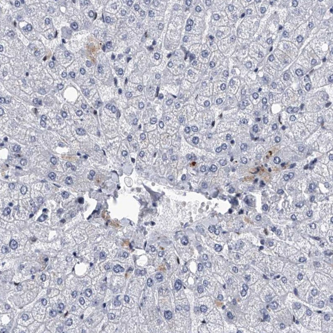 FTSJD2 Antibody in Immunohistochemistry (IHC)