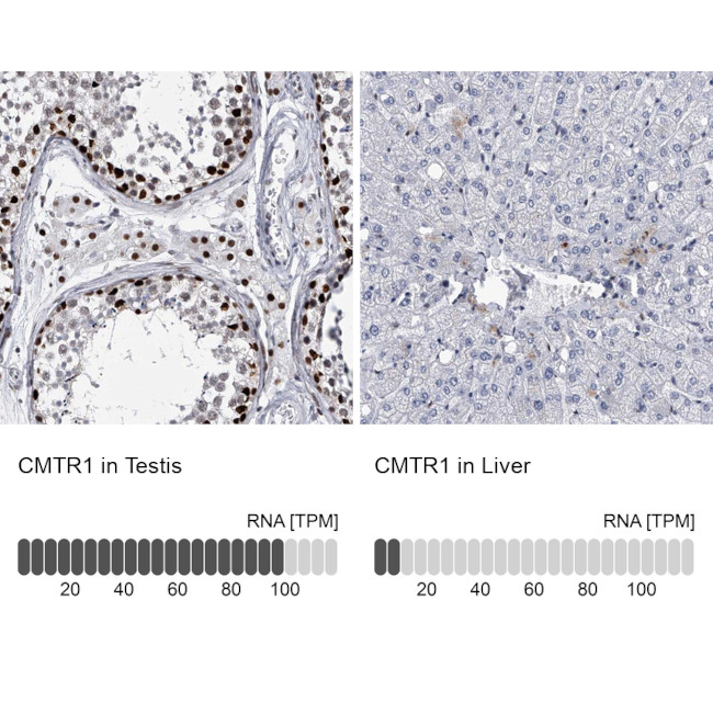 FTSJD2 Antibody