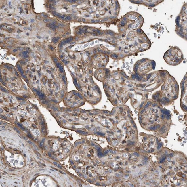 RSPO3 Antibody in Immunohistochemistry (IHC)