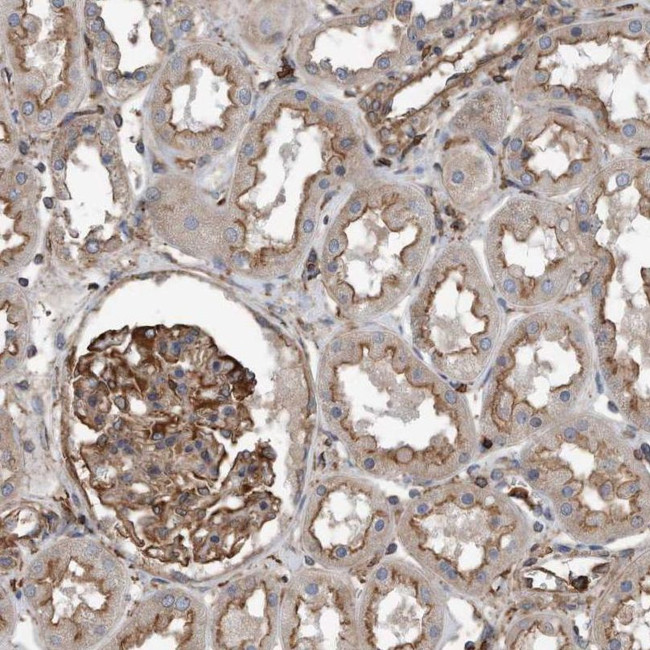 RSPO3 Antibody in Immunohistochemistry (IHC)