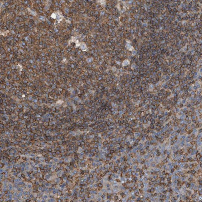 RSPO3 Antibody in Immunohistochemistry (IHC)