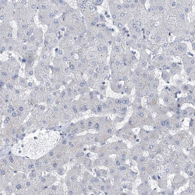 NUFIP1 Antibody in Immunohistochemistry (IHC)