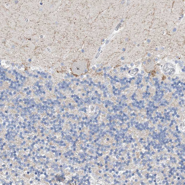 NUFIP1 Antibody in Immunohistochemistry (IHC)