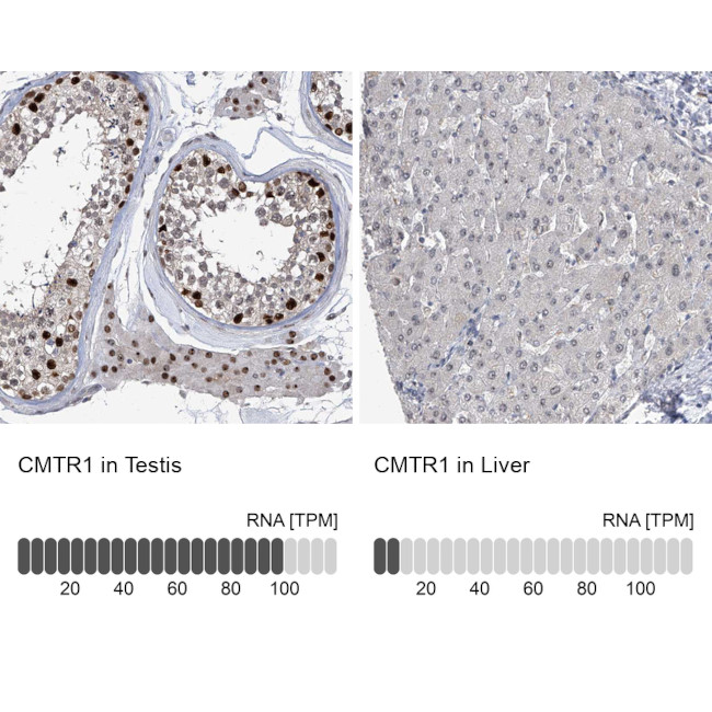 FTSJD2 Antibody in Immunohistochemistry (IHC)