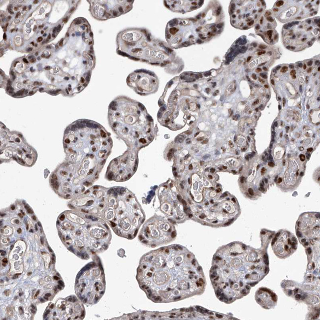 FTSJD2 Antibody in Immunohistochemistry (IHC)