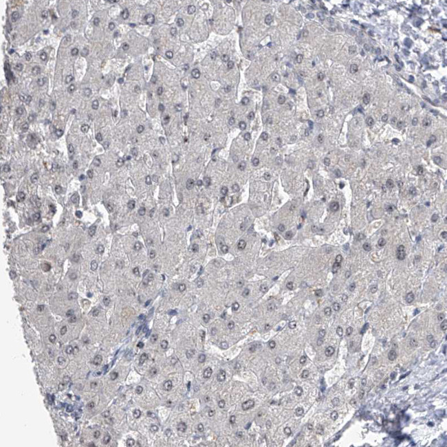 FTSJD2 Antibody in Immunohistochemistry (IHC)