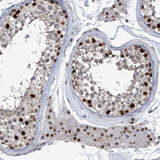 FTSJD2 Antibody in Immunohistochemistry (IHC)