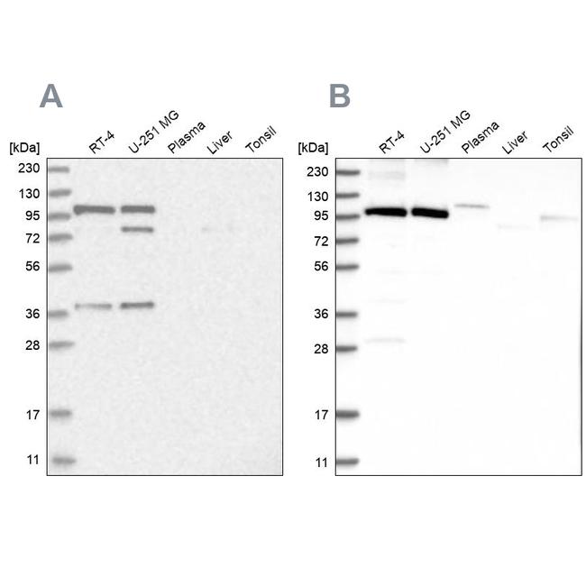 FTSJD2 Antibody in Western Blot (WB)