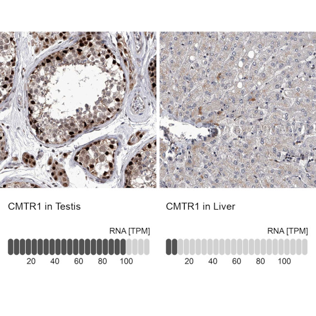 FTSJD2 Antibody in Immunohistochemistry (IHC)