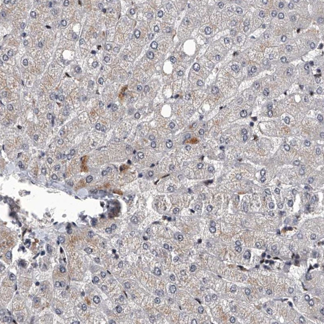 FTSJD2 Antibody in Immunohistochemistry (IHC)