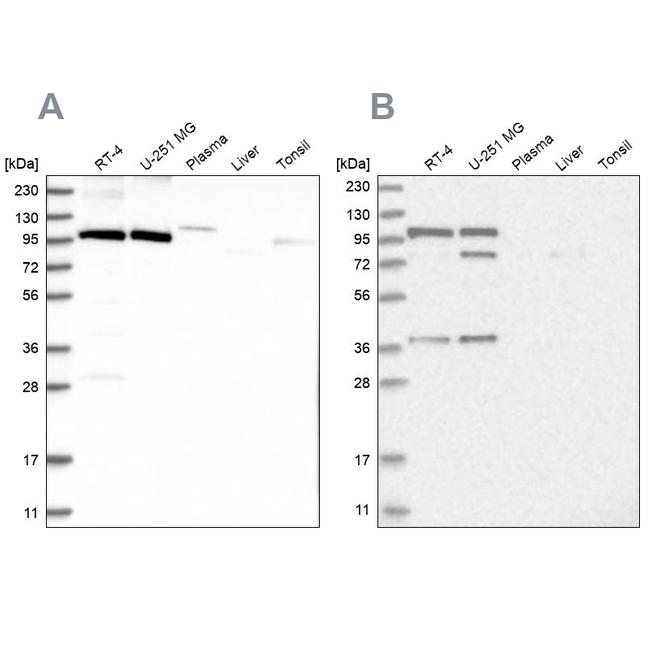 FTSJD2 Antibody in Western Blot (WB)