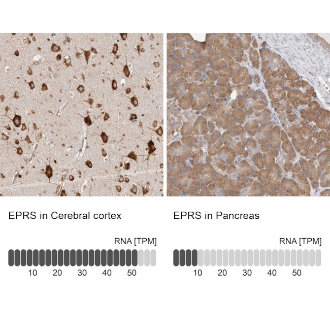 EPRS Antibody in Immunohistochemistry (IHC)