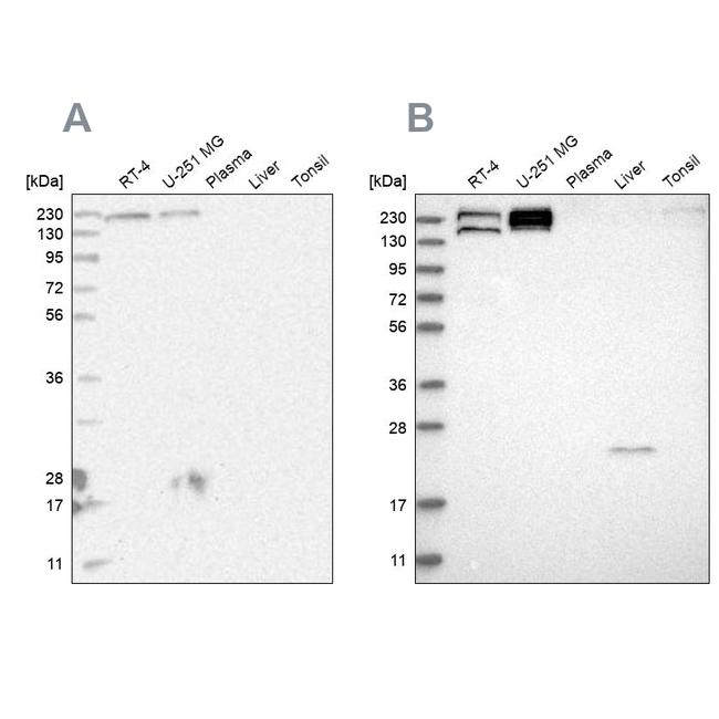 EPRS Antibody in Western Blot (WB)