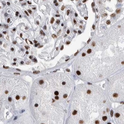 SF3A1 Antibody in Immunohistochemistry (IHC)