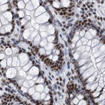 SF3A1 Antibody in Immunohistochemistry (IHC)